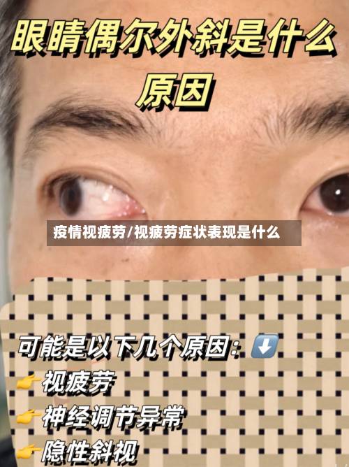 疫情视疲劳/视疲劳症状表现是什么