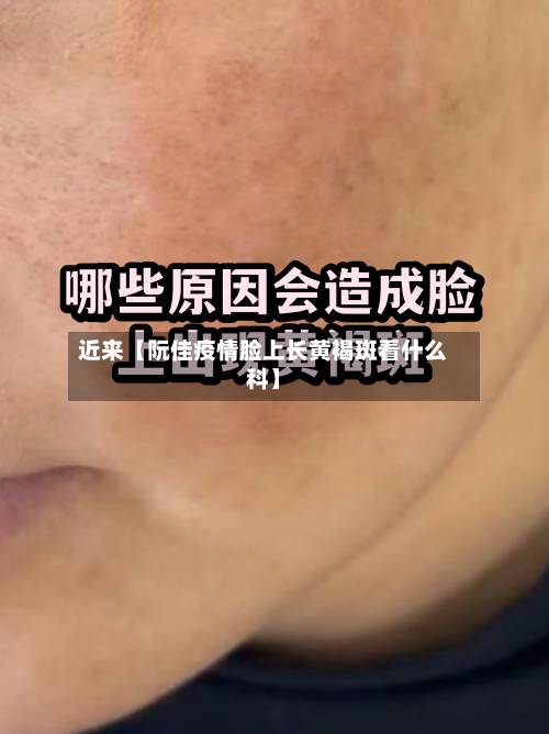 近来【阮佳疫情脸上长黄褐斑看什么科】-第2张图片